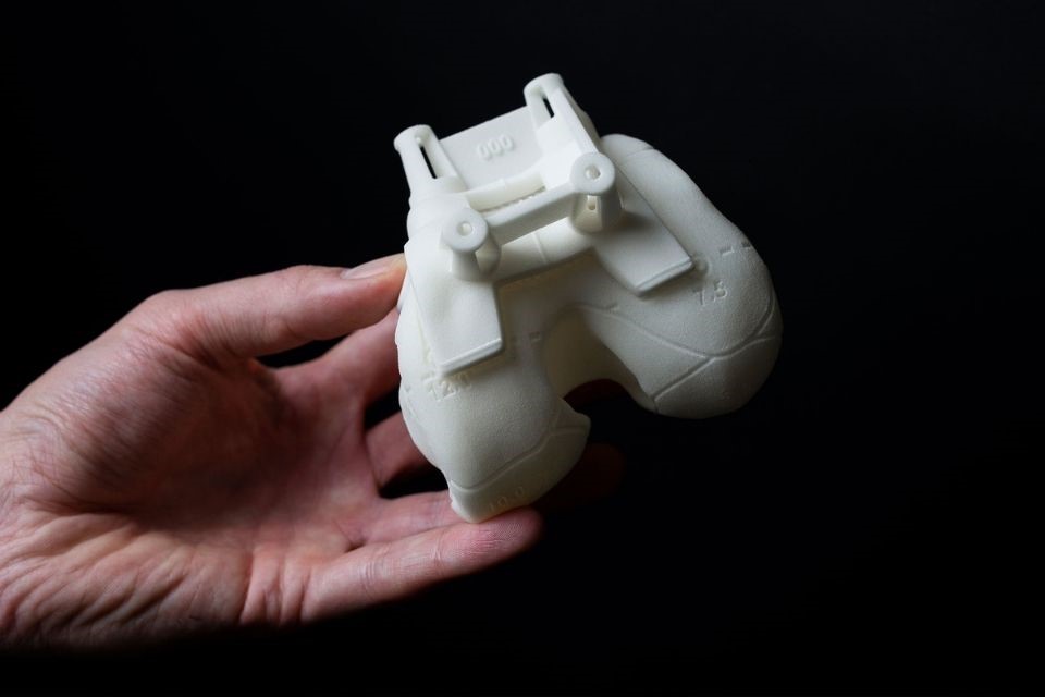 Customized knee joint prosthesis
